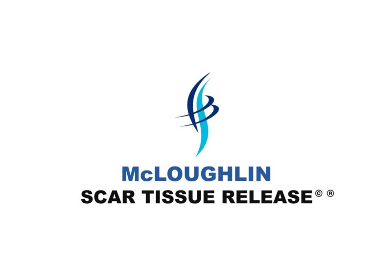 McLoughlin Scar Tissue Release: SCP Podcast 169